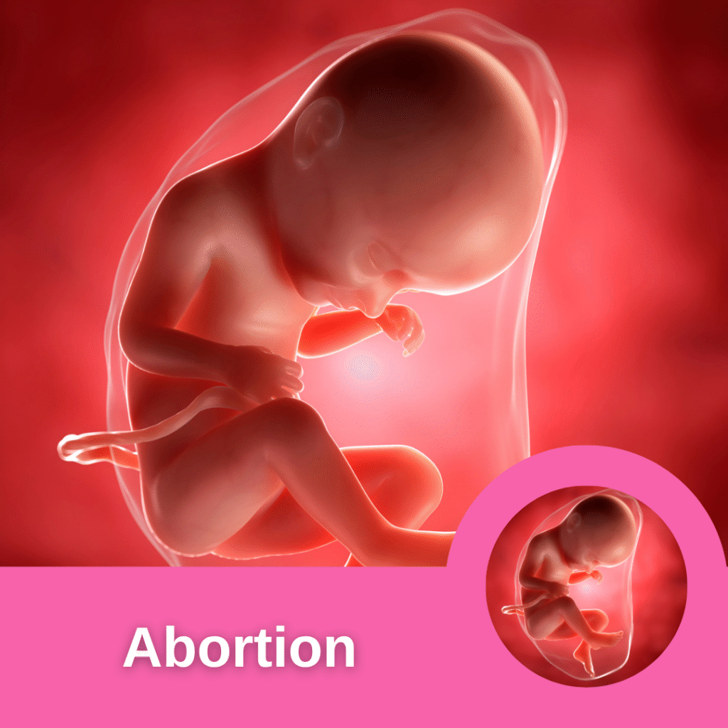 Abortion