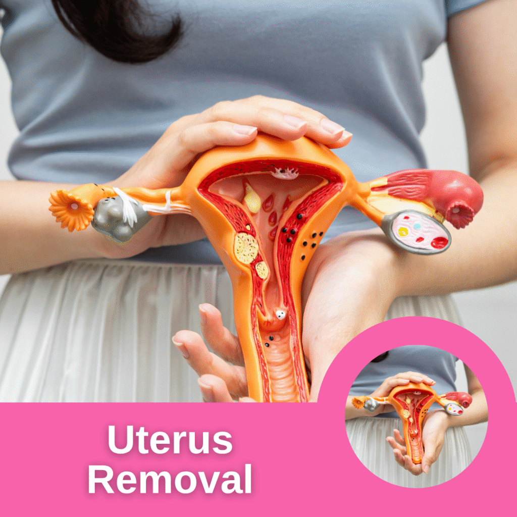 Uterus Removal