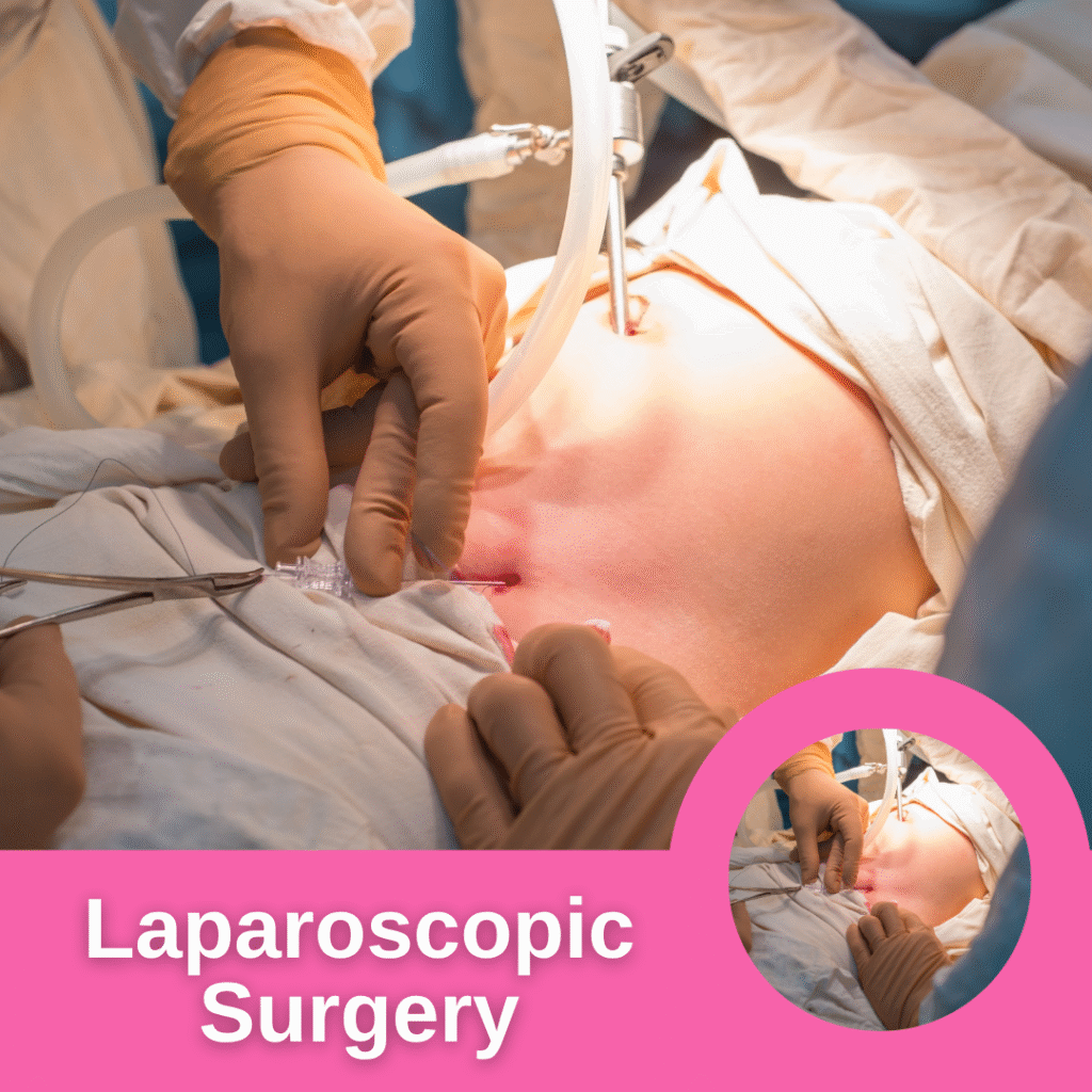 Laparoscopic Surgery