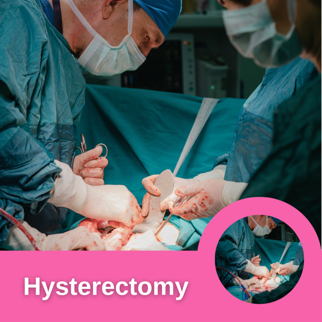 Hysterectomy