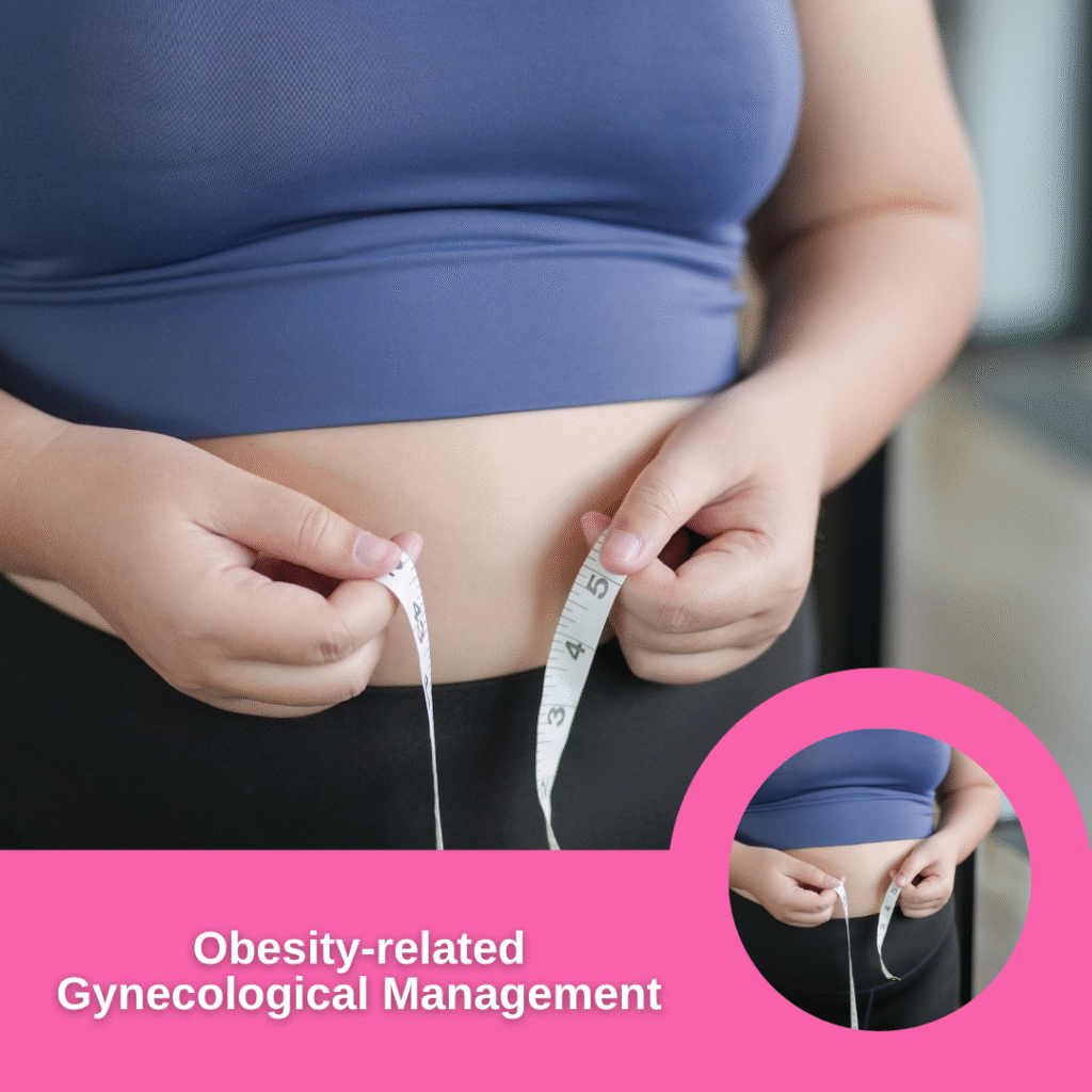 Obesity-related Gynecological Management